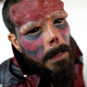 Illustration for article titled Man Removes Nose to Look More Like Red Skull